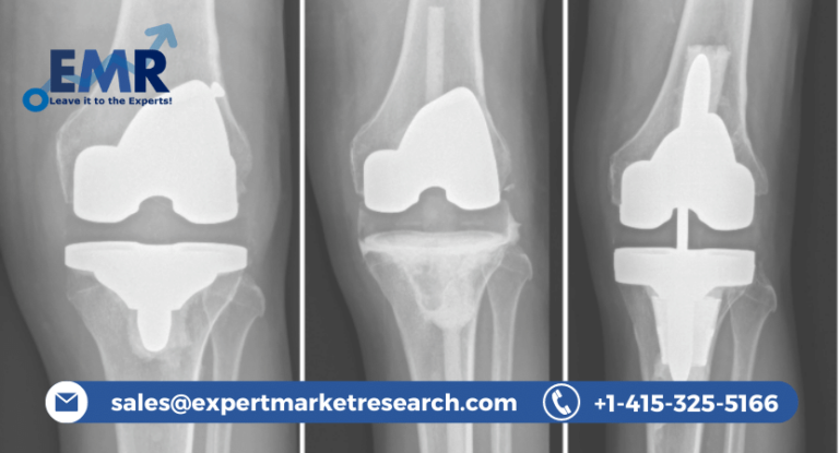 Antibiotic Bone Cement Market Size, Share, Report, Growth, Analysis, Price, Outlook and Forecast Period 2021-2026