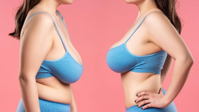 Signs of healthy breasts: Here’s when to worry