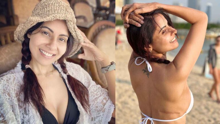 Chhavi Mittal: My breast surgery scars are my battle scars, I’m proud of them