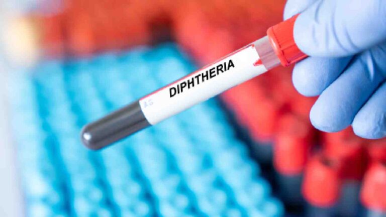 Diphtheria is claiming lives in Nigeria: Know all about its symptoms in children