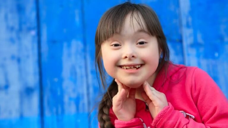 Living with Down Syndrome: Know its symptoms and causes